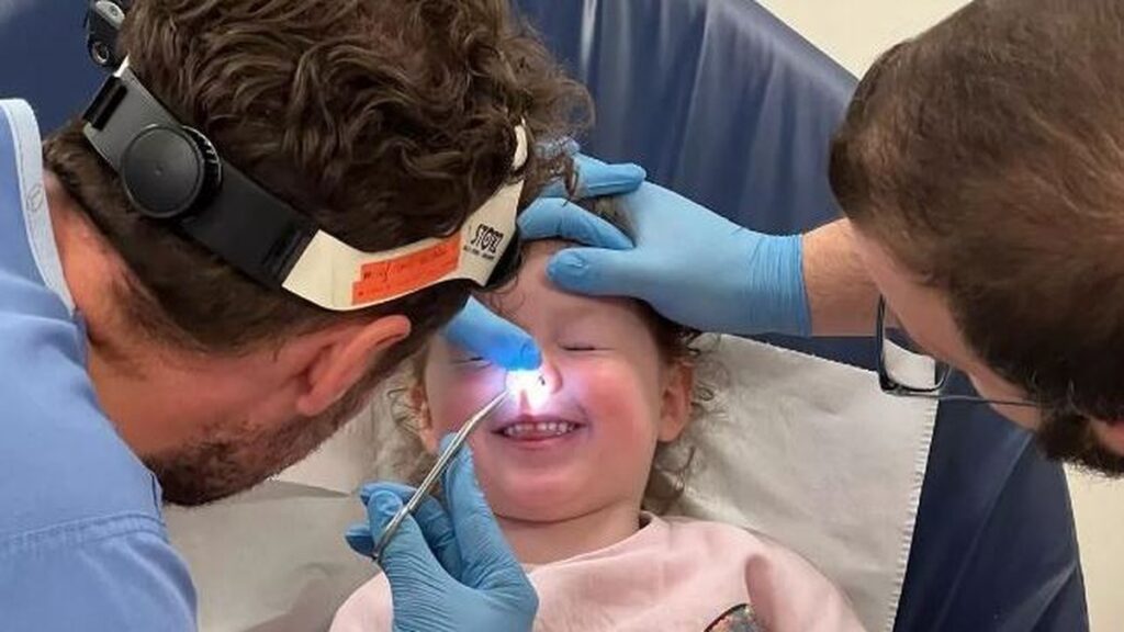 Criança fica com uva-passa presa no nariz por três a quatro meses no Reino Unido