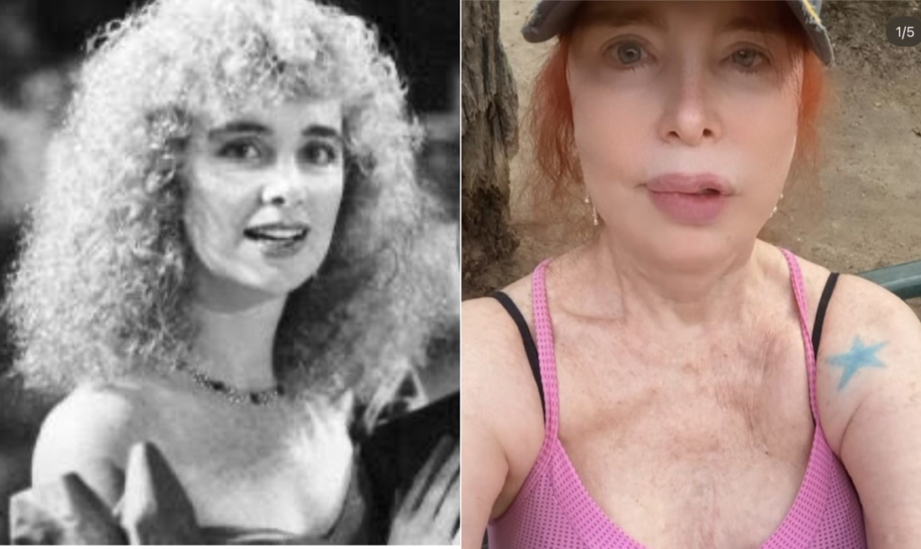 Estrela da década de 1980, Ísis de Oliveira surge com a boca inchada e explica motivo: 'Estou até linda'