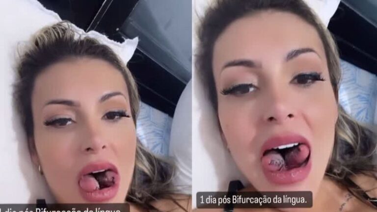 Andressa Urach faz bifurcação e mostra detalhes de método: "Dificuldade de engolir"