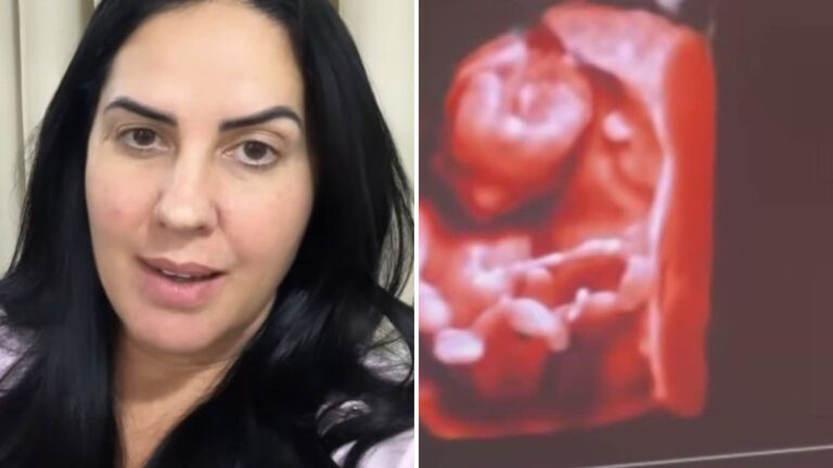 São dois? Graciele Lacerda mostra ultrassom pela primeira vez: "Não para de se mexer"