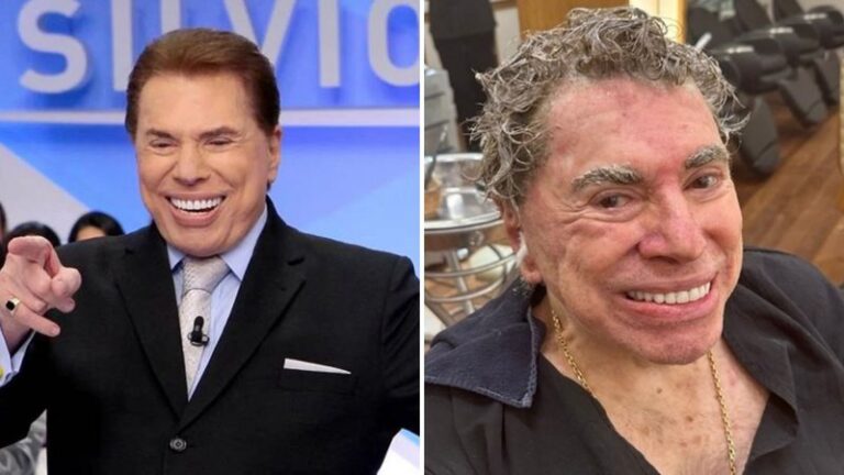 Quantas plásticas Silvio Santos tinha? Apresentador não fez última por medo de morrer