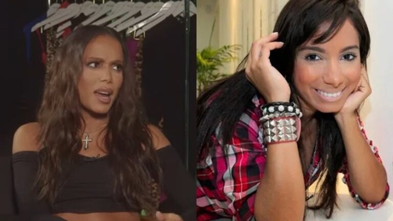 Anitta compara antes e depois de plásticas ao rever foto antiga: "Não era linda"