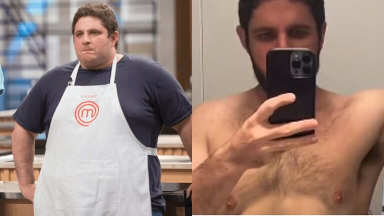 Ex-Masterchef exibe antes e depois e revela como perdeu 83 kg: 'Sem fazer cirurgia'