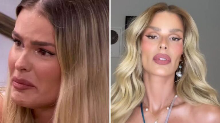 O que Yasmin Brunet fez no rosto? Entenda por que a modelo está levando hate