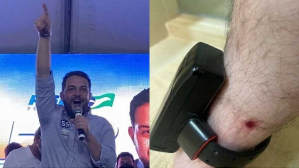 Claudinho Serra exibe ferida na perna e quer tirar tornozeleira eletrônica em MS